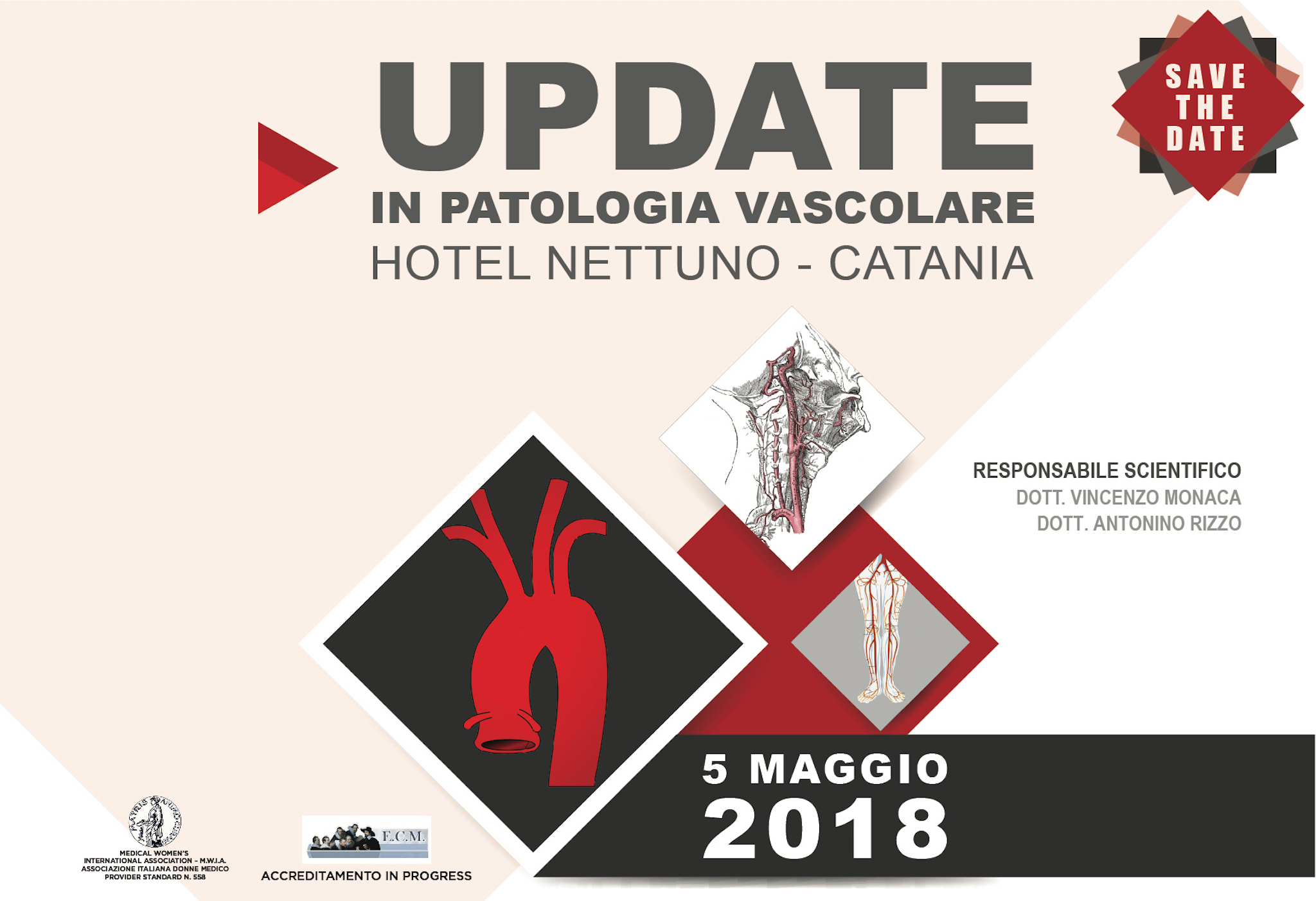 Updates in Patologia Vascolare Catania Hotel Nettuno 5 Maggio 2018